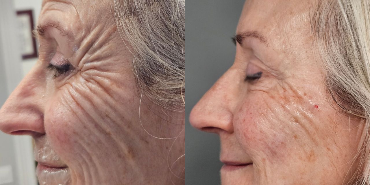 Rosalba Herrero Zerpa-20