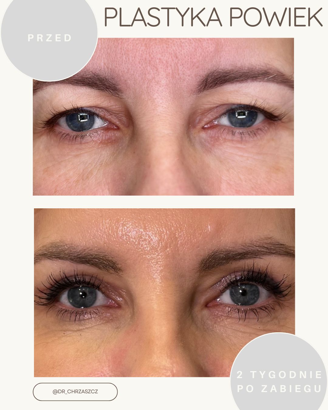 Michał Chrząszcz-9