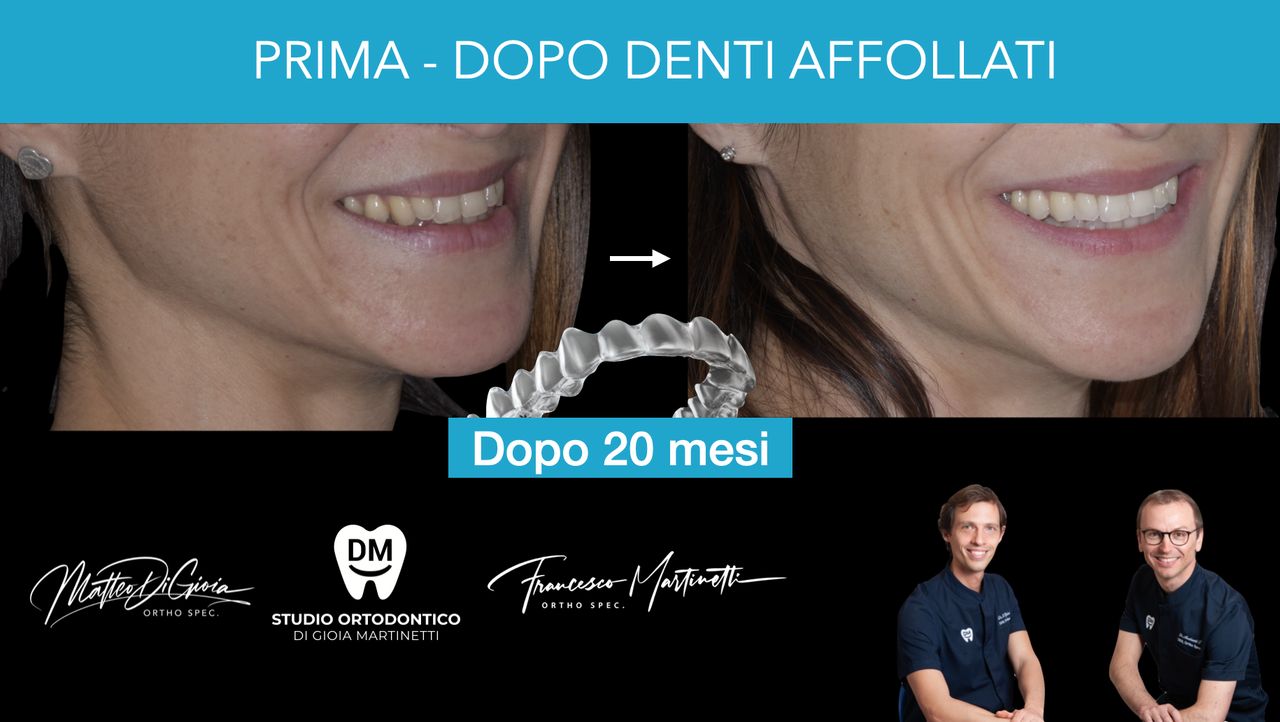 Francesco Martinetti-0