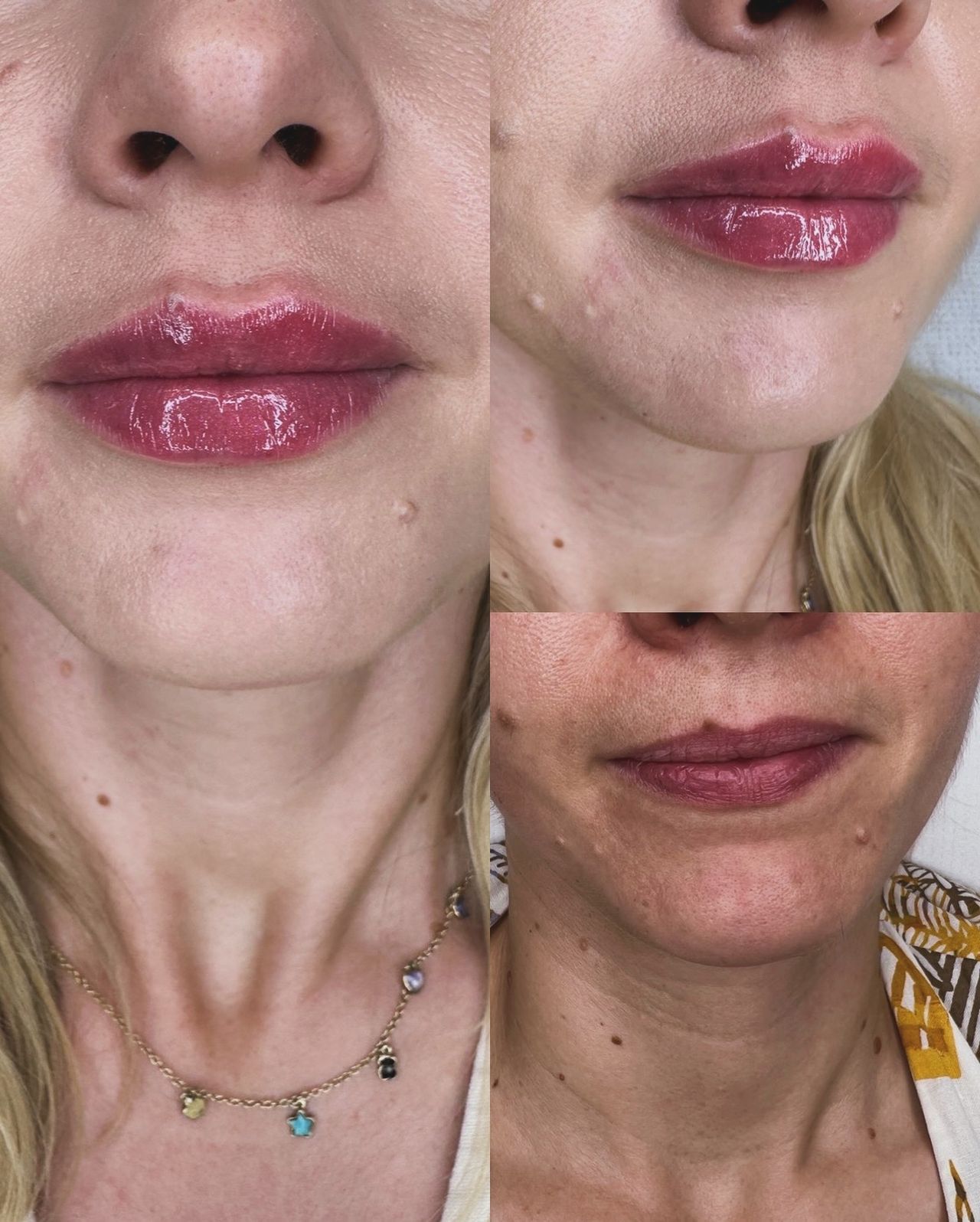 Michalina Zagańczyk-Bączek-26