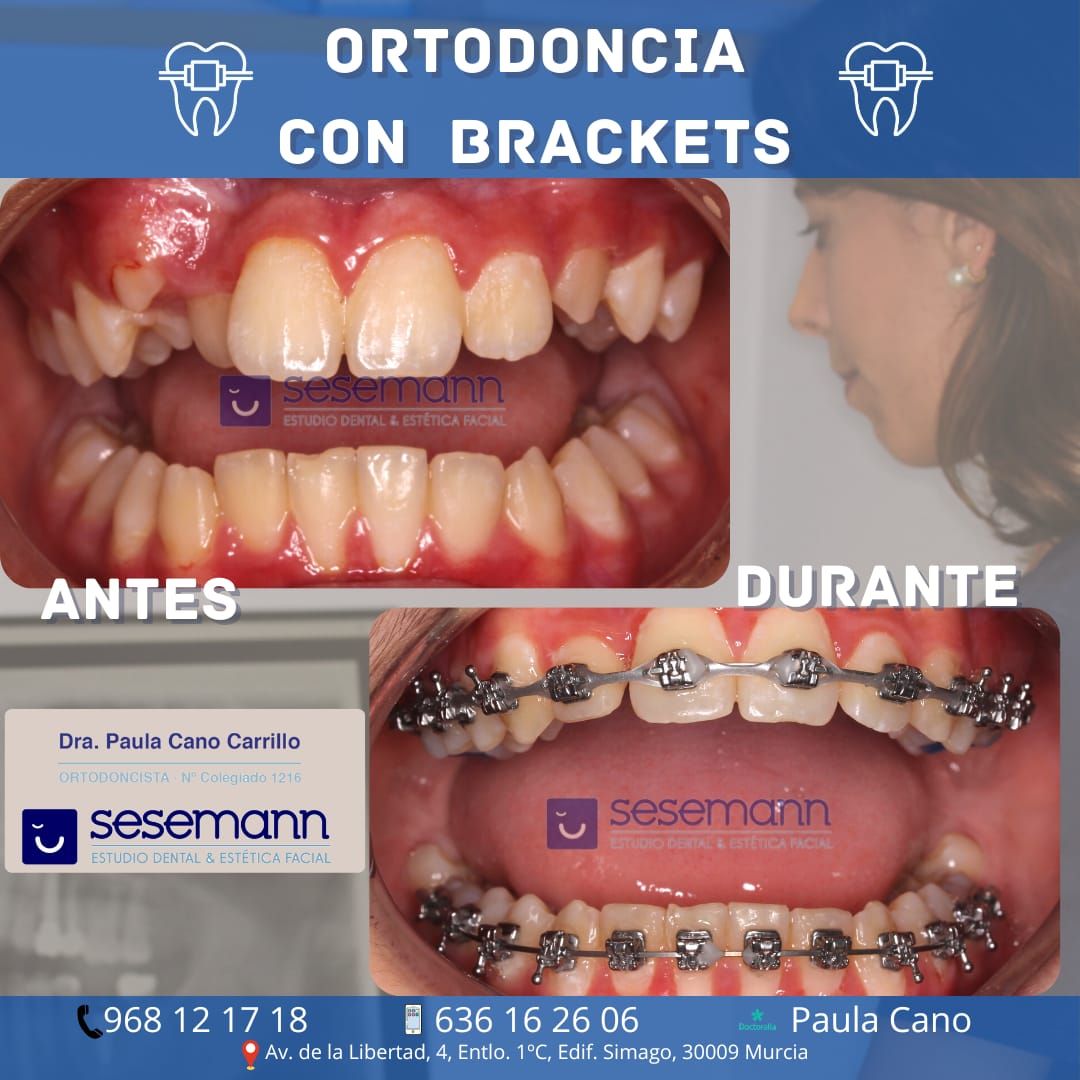 Paula Cano Carrillo-10