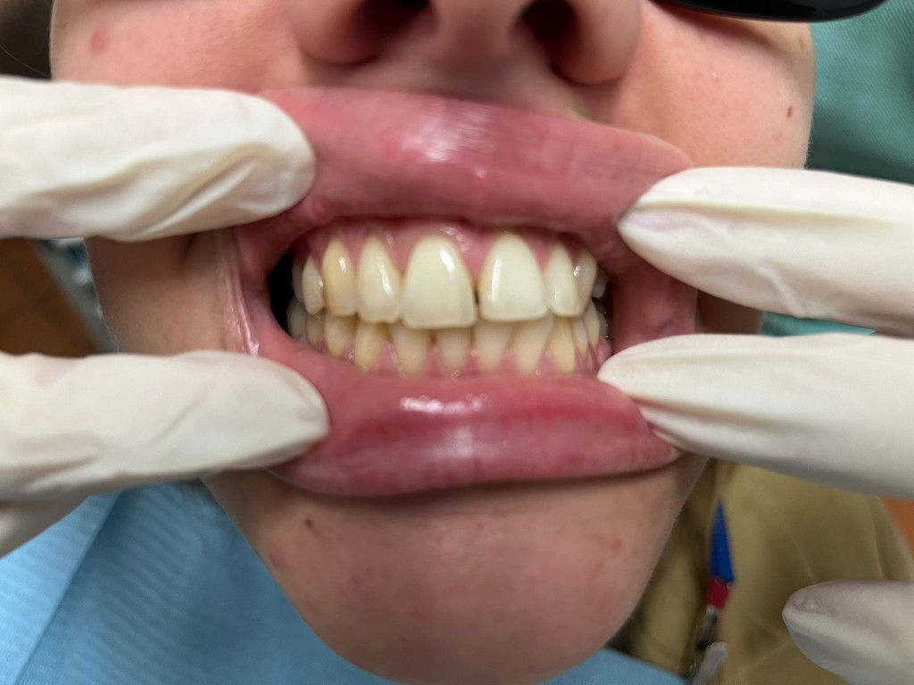 Riunito Dentista Dentalpar-15