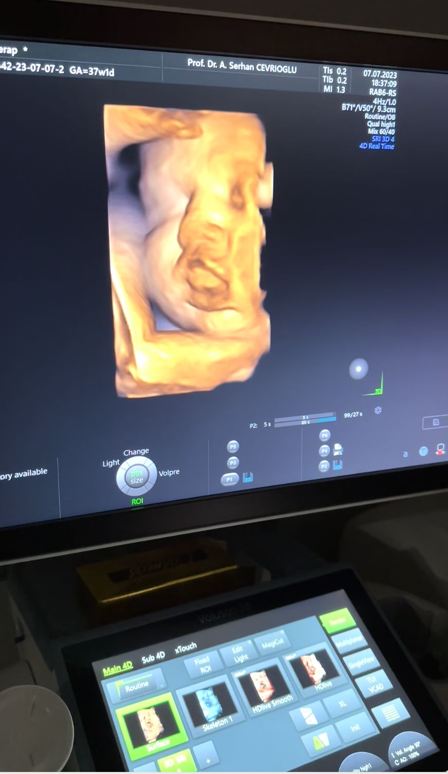 Arif Serhan Cevrioğlu-2