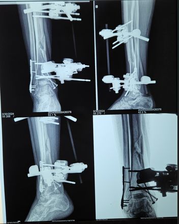 Gennaro Campopiano-7