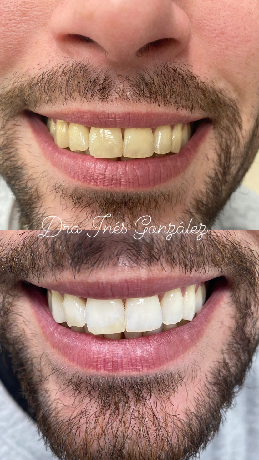 Inés Gonzalez Ordoño-5