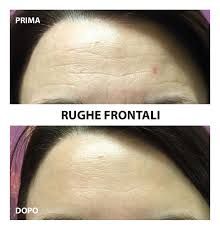 Paolo Bastianelli-38