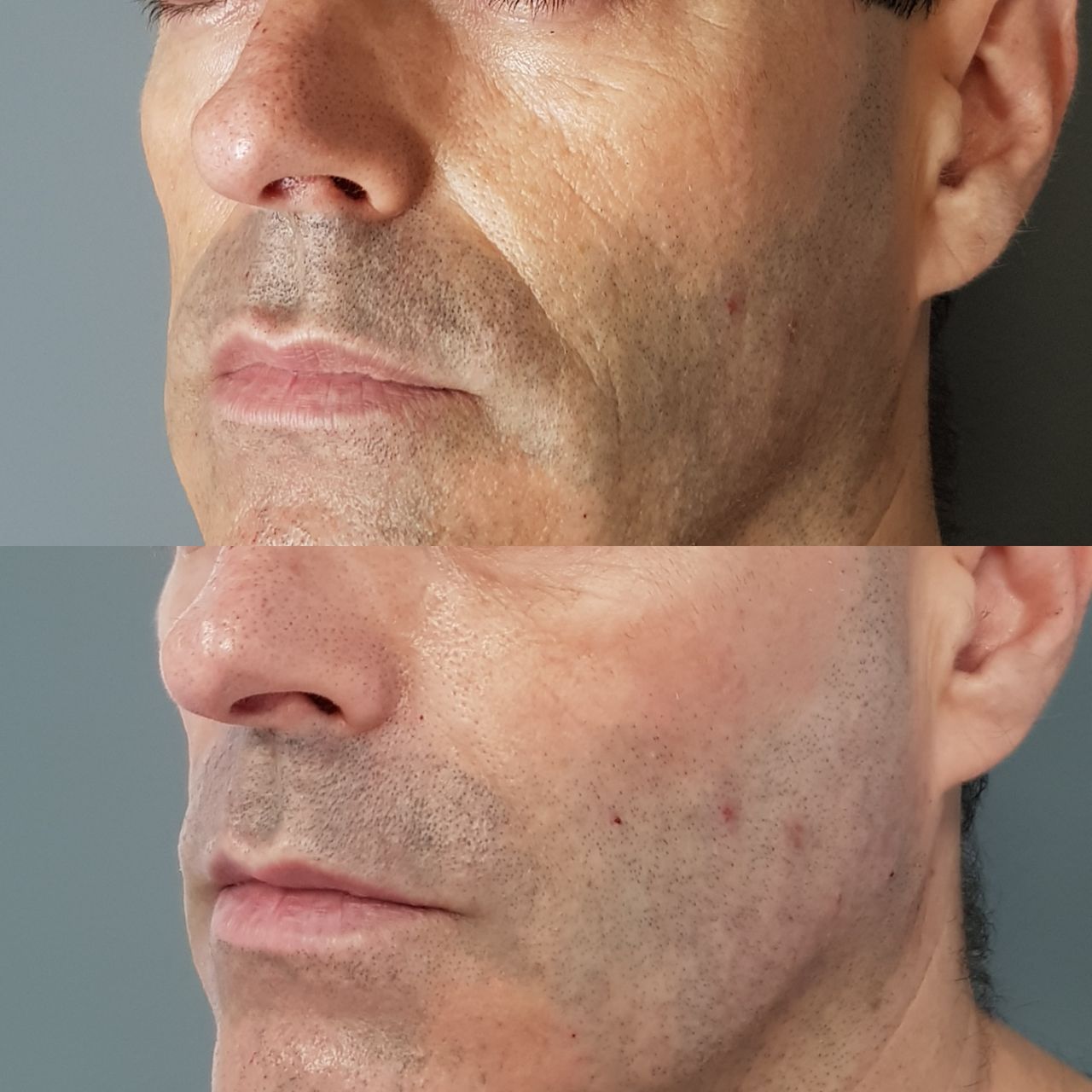 Rosalba Herrero Zerpa-252