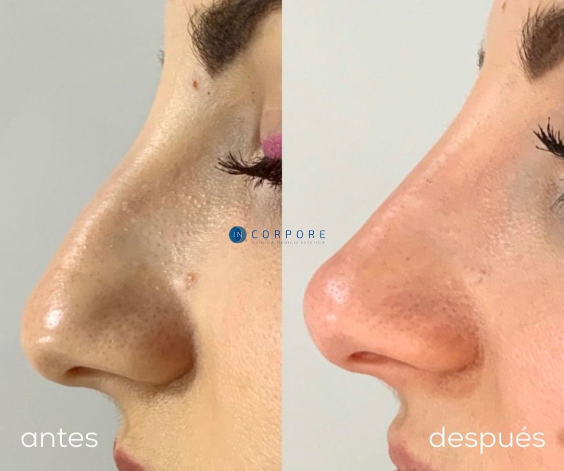 Juan Enrique Pérez Enríquez-7