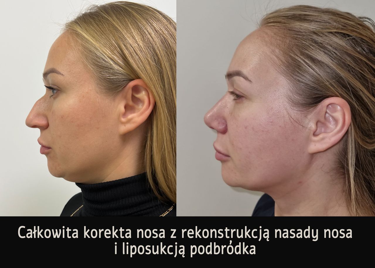 Mariusz Zagajewski-25