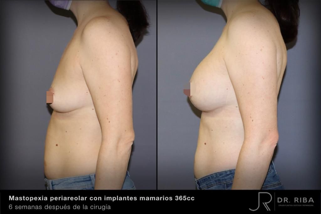 Jordi Riba Vilchez-48