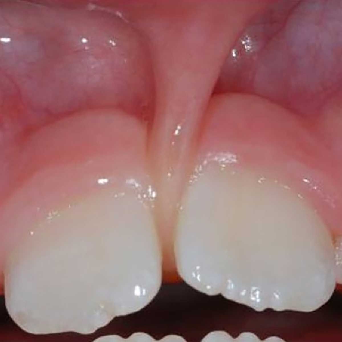 Gianluigi Bittante-29