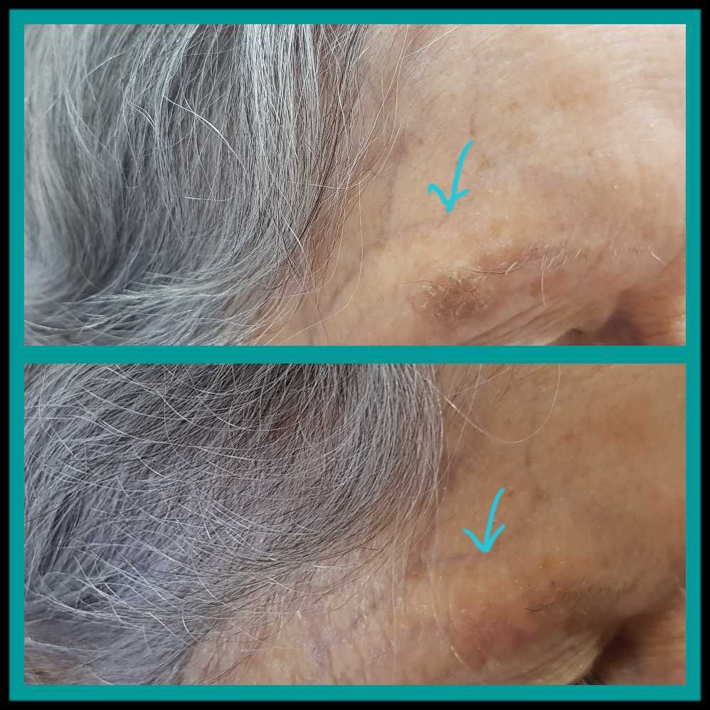 Rosalba Herrero Zerpa-358