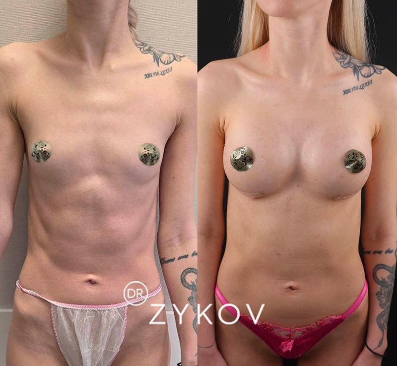 Valentin Zykov-8