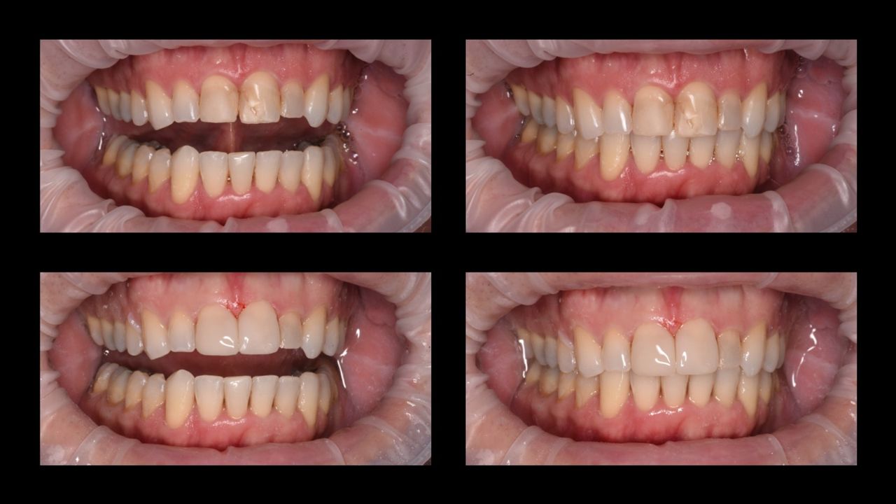 Raúl Cobos Torrero-0