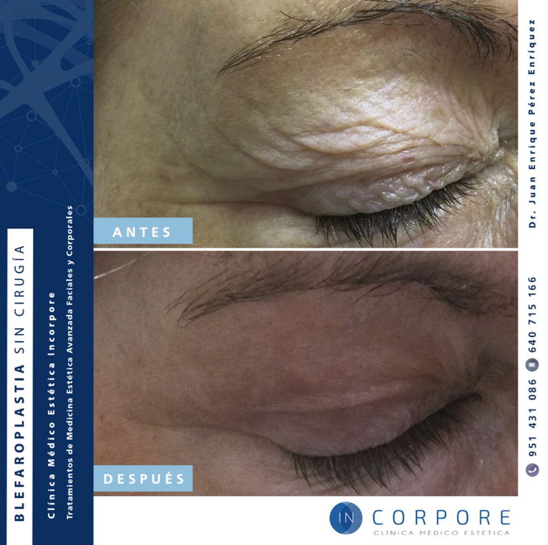 Juan Enrique Pérez Enríquez-116