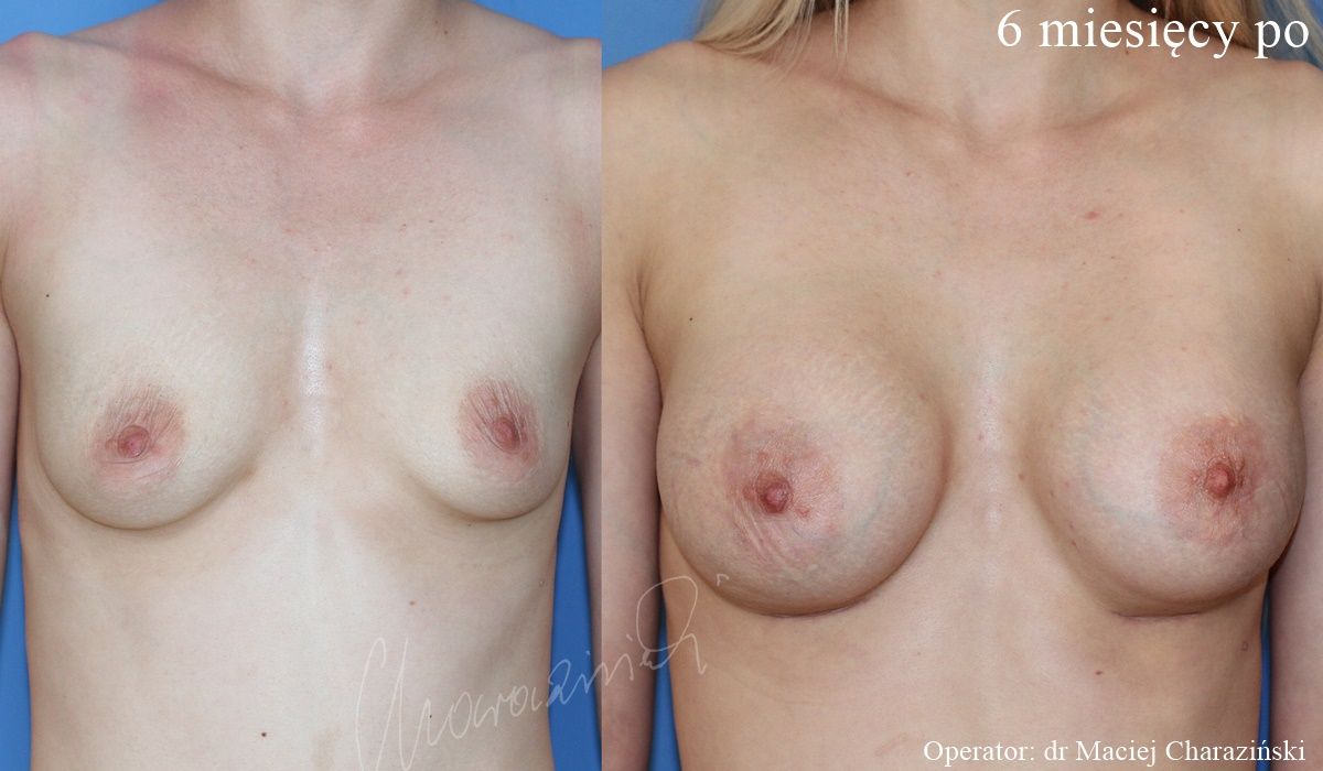 Maciej Charaziński-129