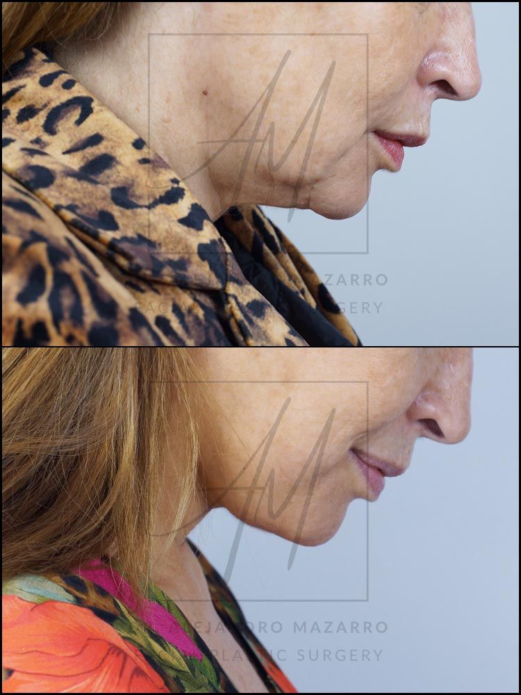 Alejandro Mazarro Campos-11