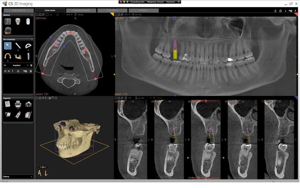Ernesto Ruiz Chumilla-5