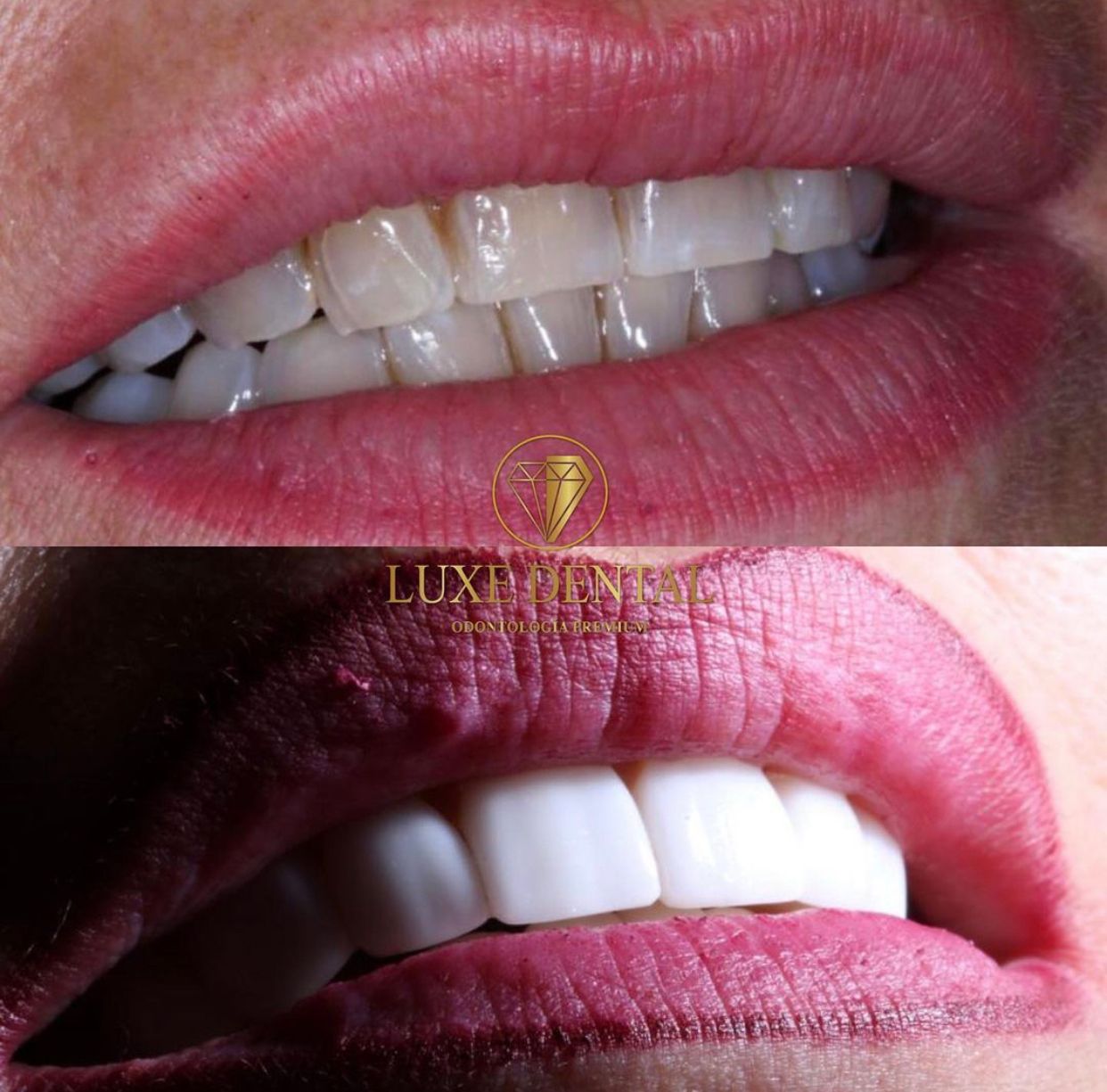 Ruben Patier Martin-0