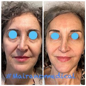 Tommaso Giorgio Mairano-0