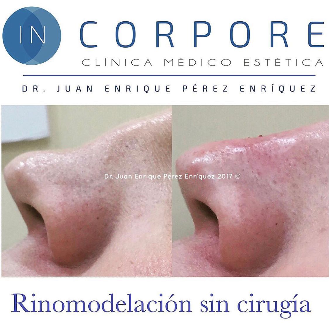 Juan Enrique Pérez Enríquez-66