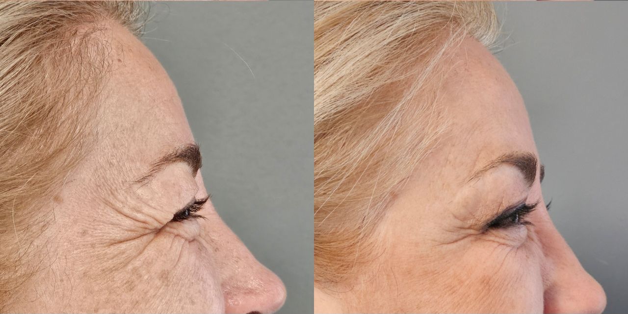 Rosalba Herrero Zerpa-549