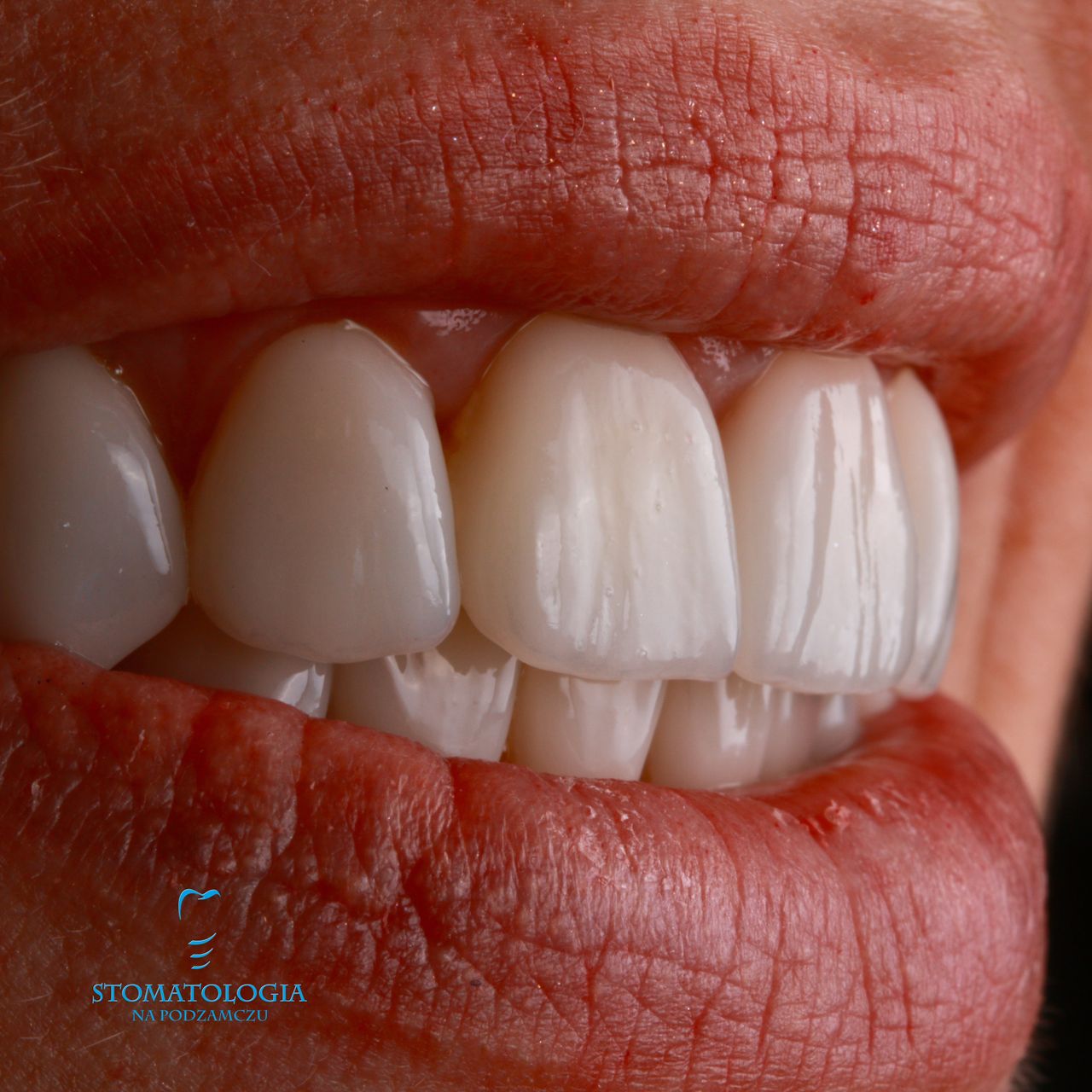 Katarzyna Matuszak-Burkowska-13