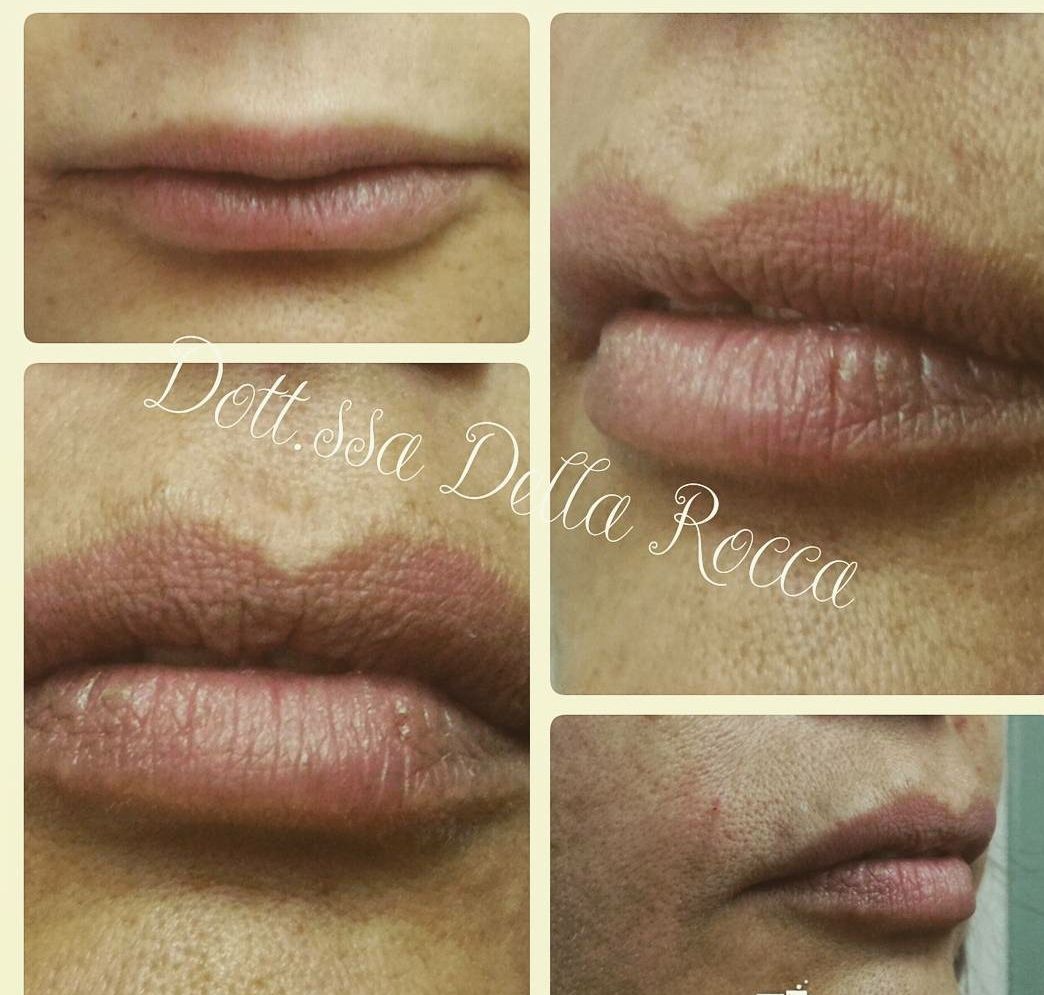 Paola Della Rocca-35