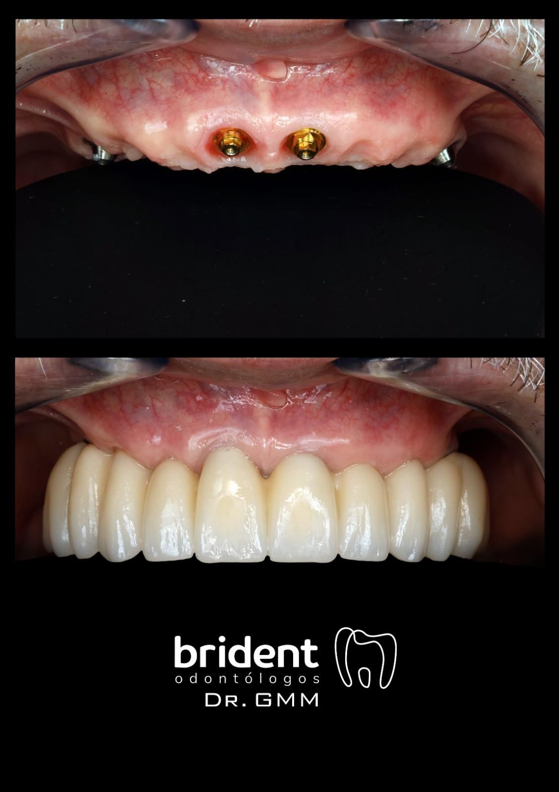 Guillermo Moreno Fragoso-52