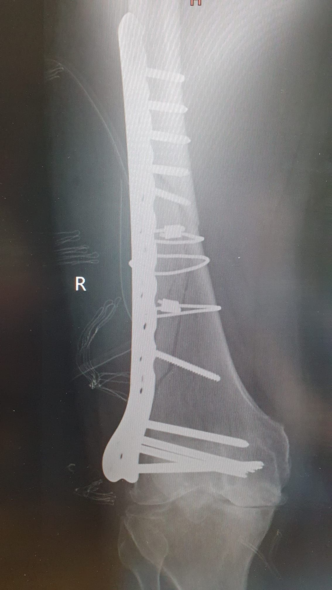 Mateusz Orzechowski-6