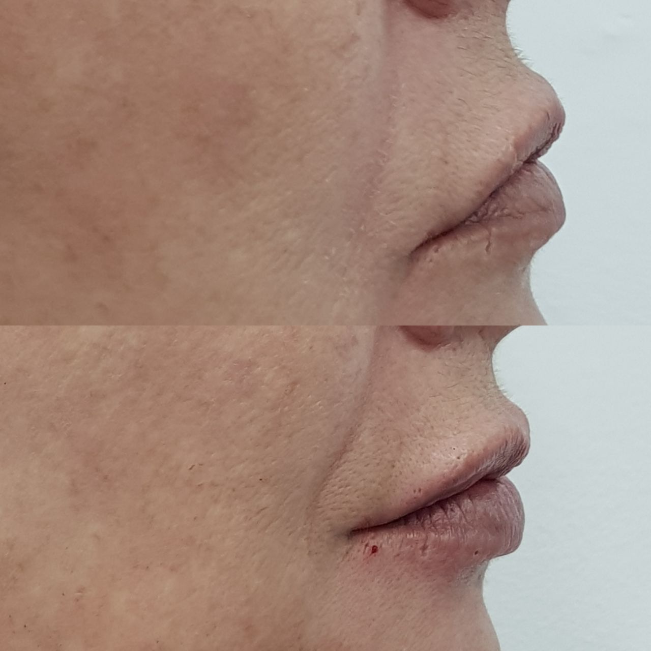 Rosalba Herrero Zerpa-246