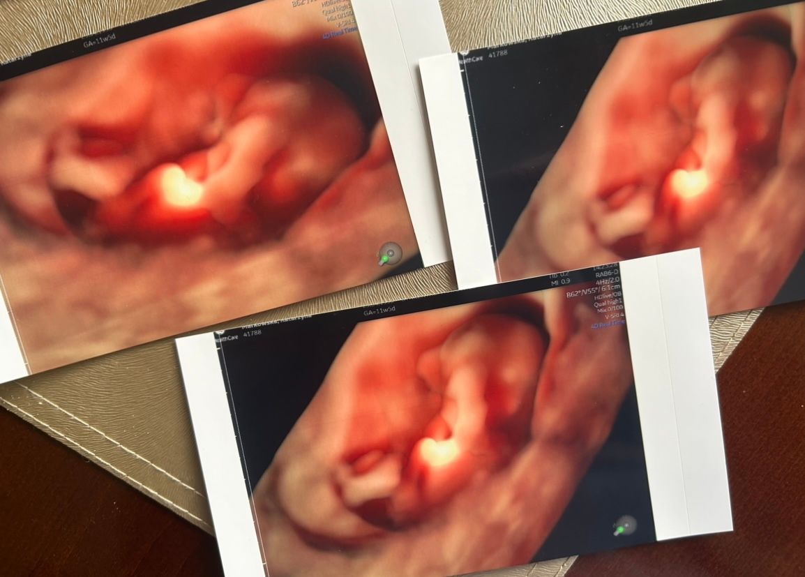 Wioletta Rozmus-Warcholińska-136