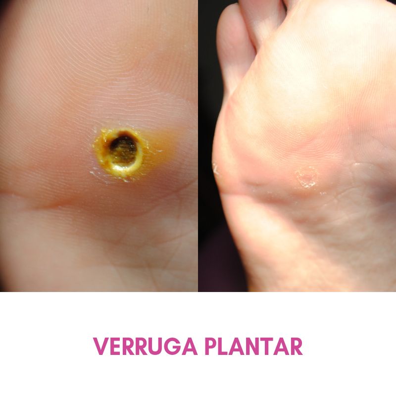 Salomé Antón Arnal-27