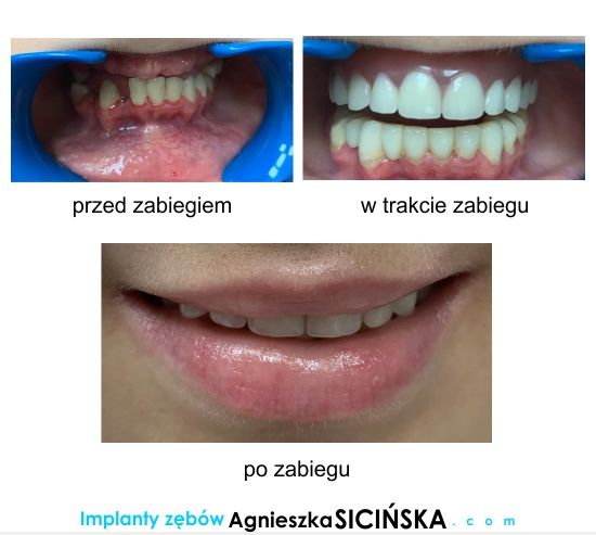 Agnieszka Ewa Sicińska-22