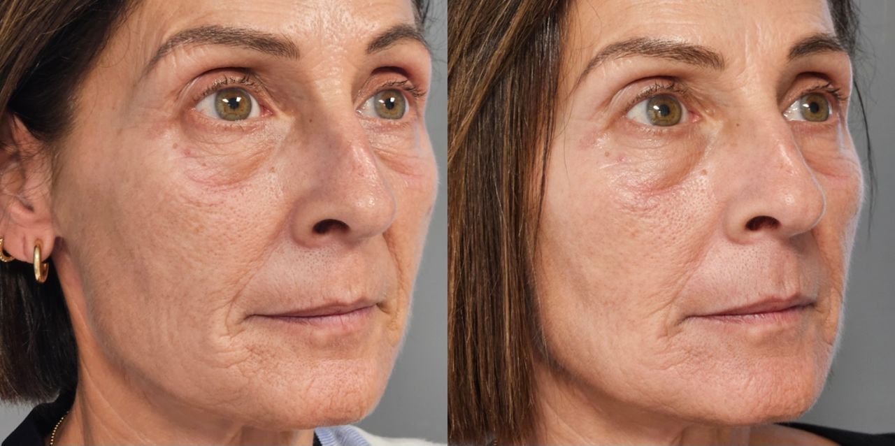 Rosalba Herrero Zerpa-535