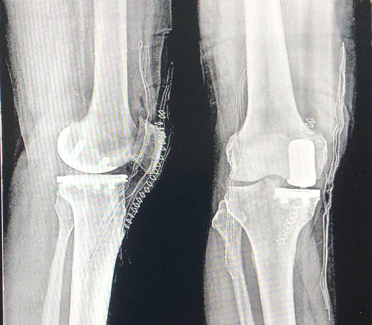 Francesco Chiazzolla-0