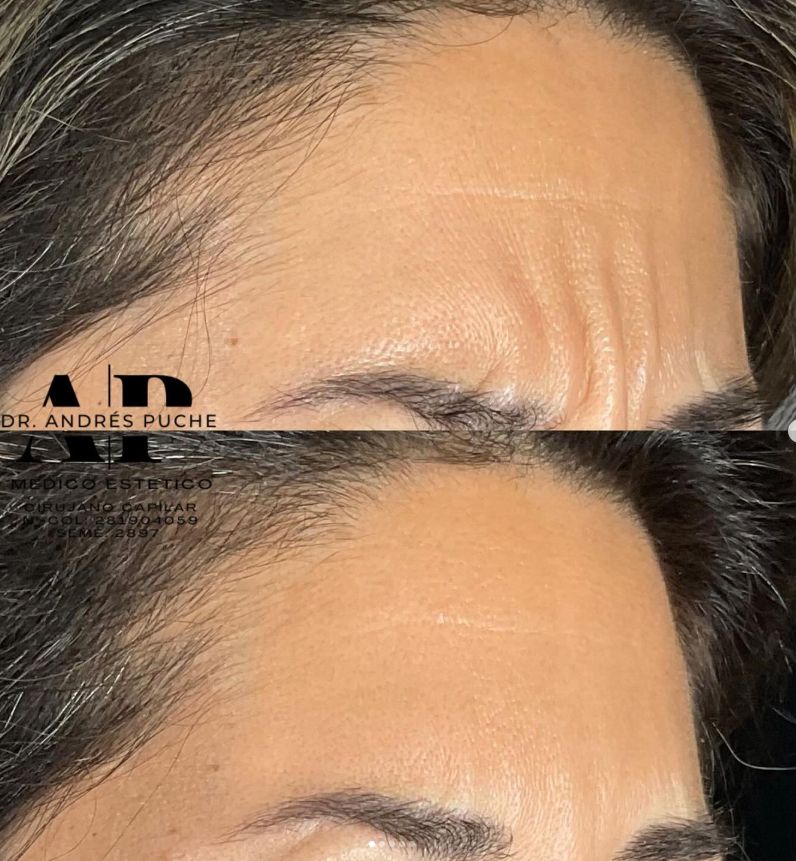 Andrés Puche Urdaneta-1