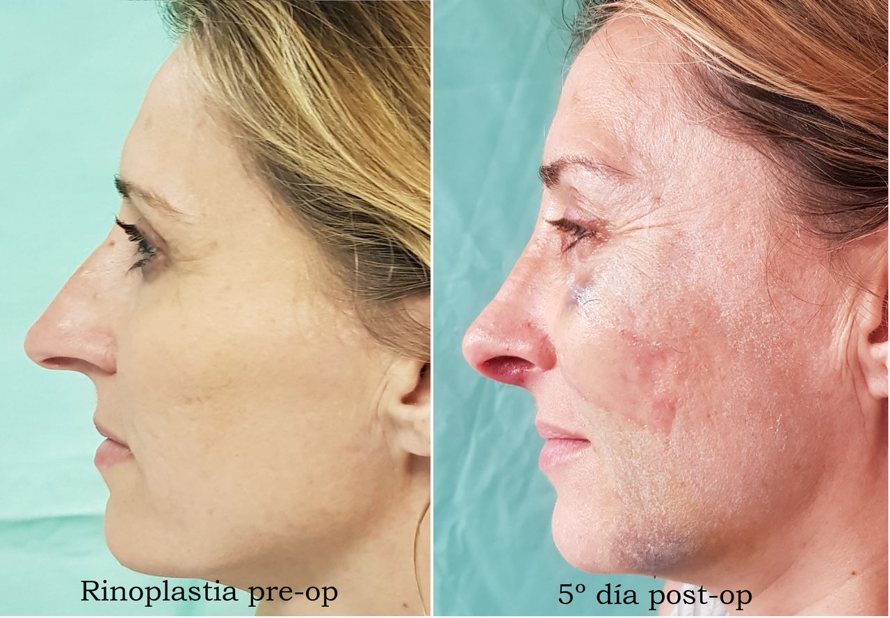 Enrique Bonanad Fernandez-6