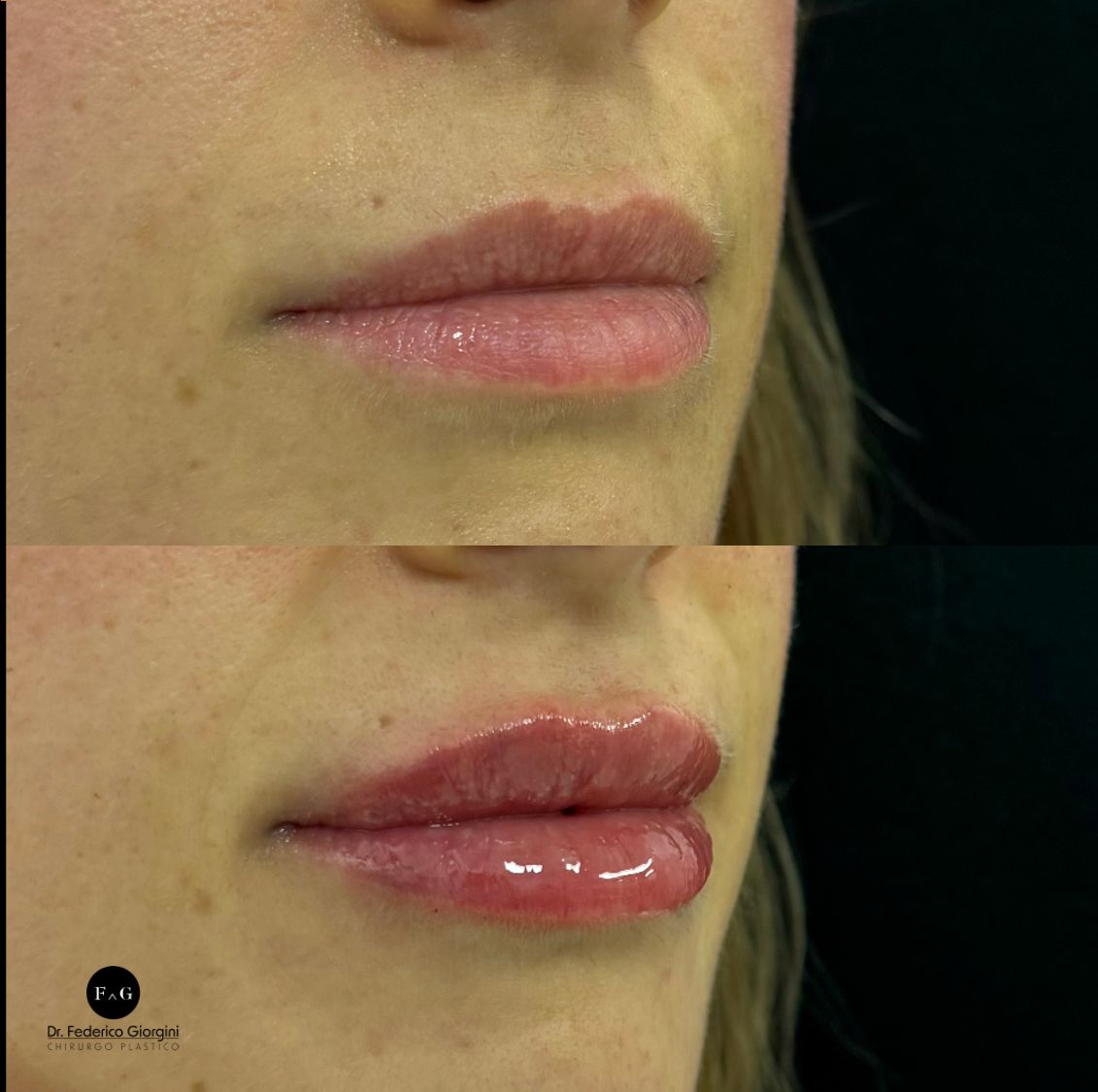 Federico Giorgini-16