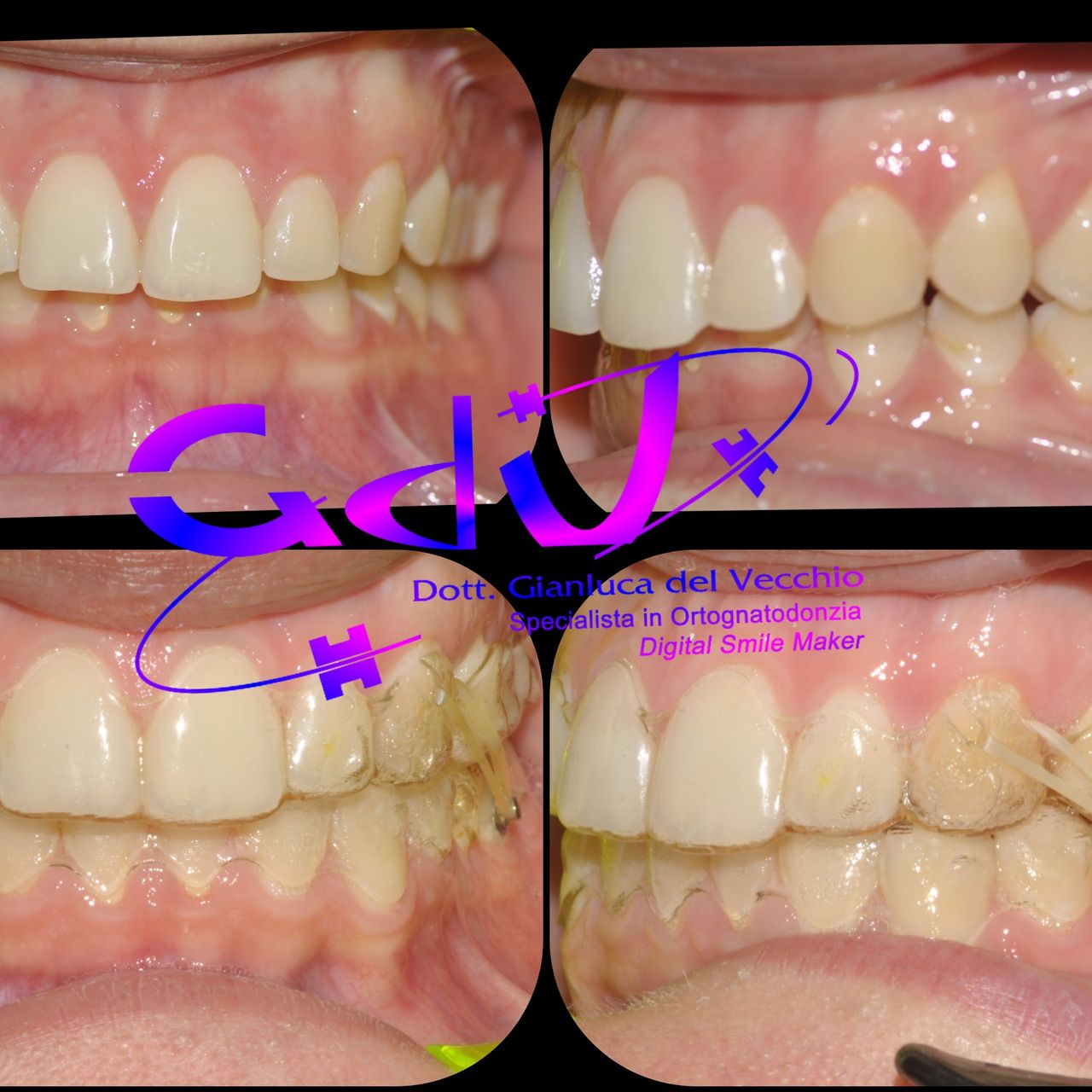 Gianluca Del Vecchio-128