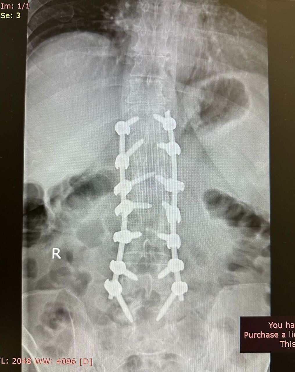 Valerio Cipolloni-28