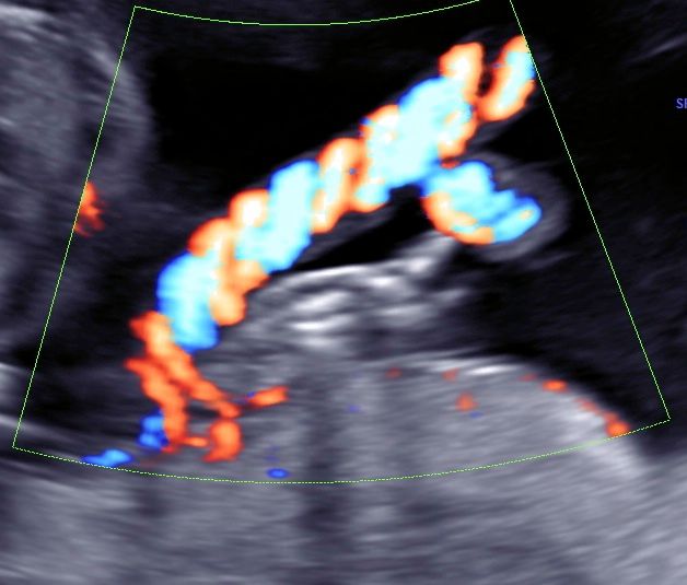 Tommaso Incandela-53