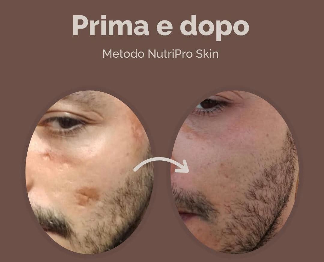 Guglielmina Chinaglia-6