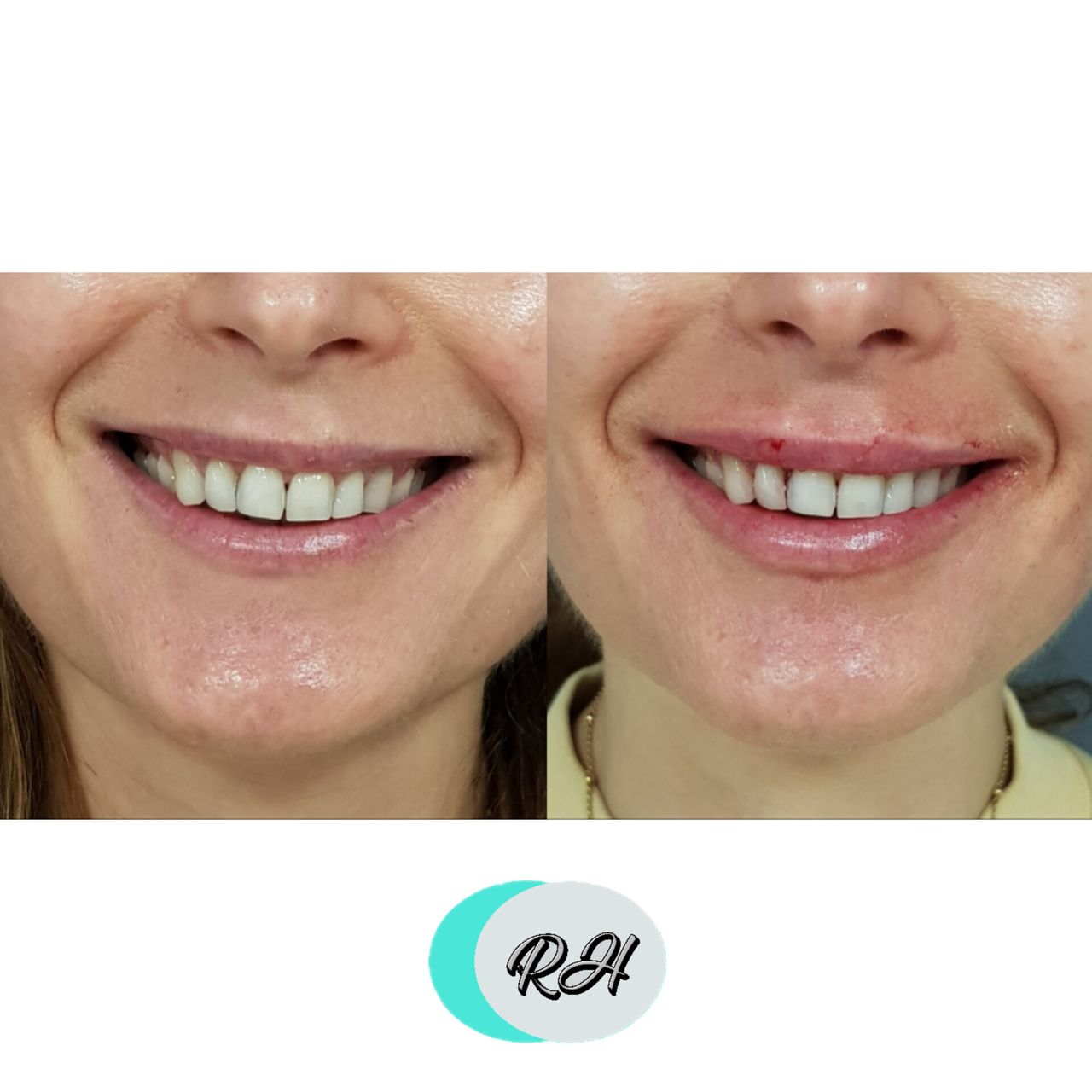 Rosalba Herrero Zerpa-135