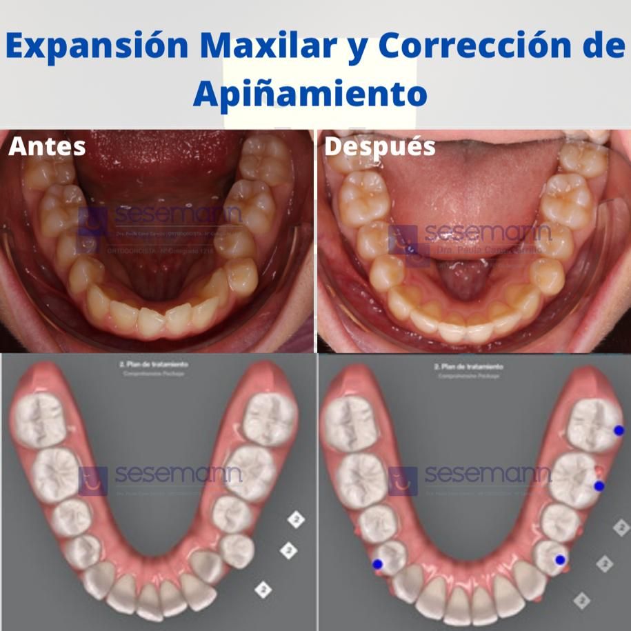 Paula Cano Carrillo-42