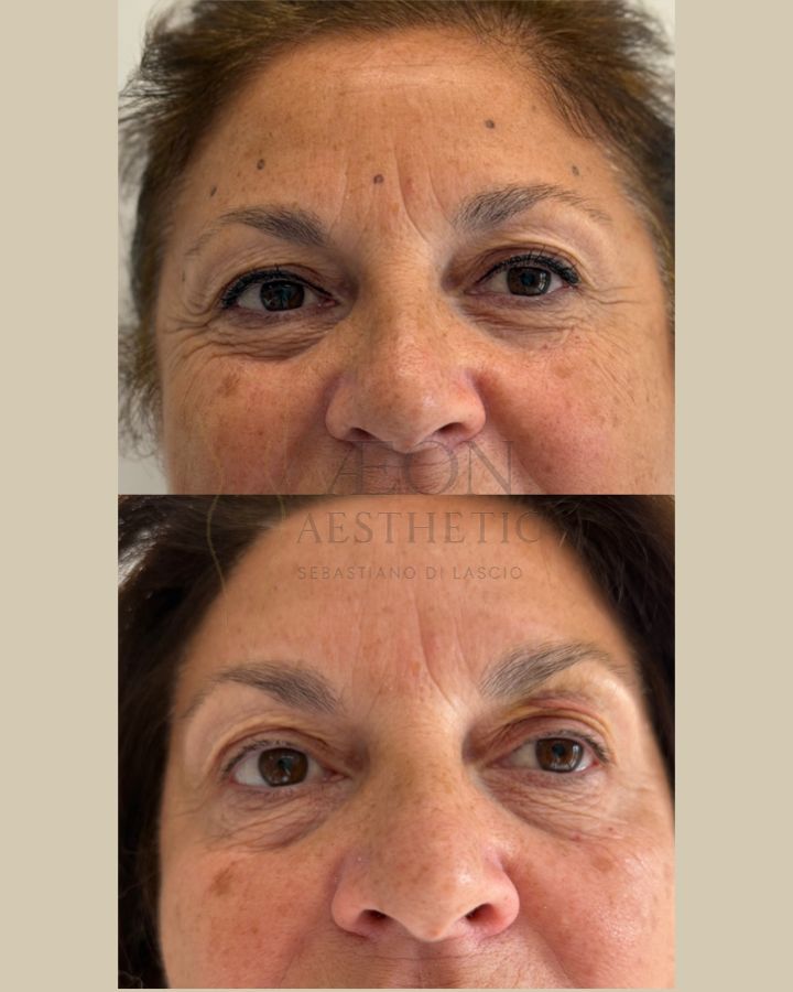 Sebastiano Di Lascio-13