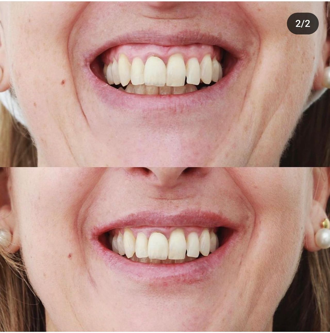 Raquel Moreno Pentinel-75