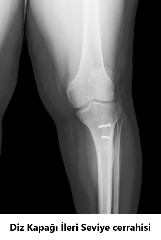 Javid M. Azarabadı-12