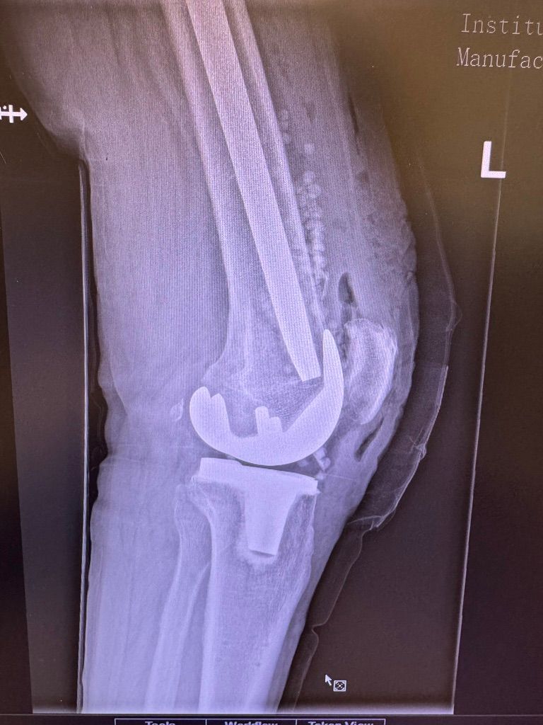 Pieralberto Valpiana-3