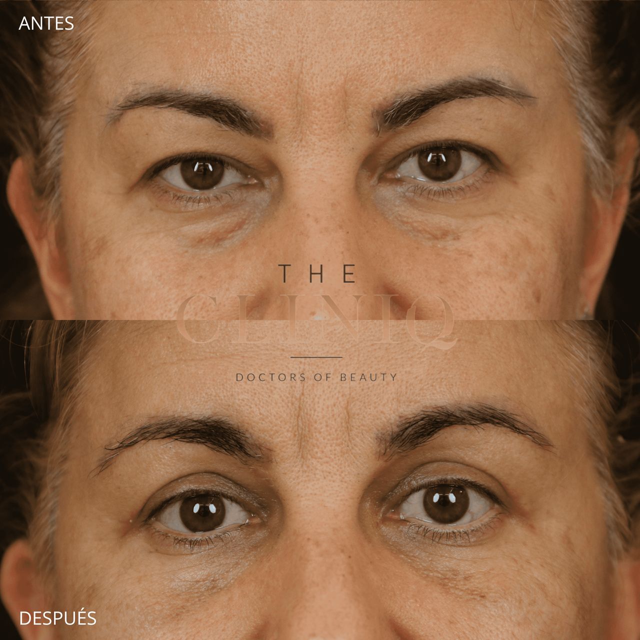 Ignacio Genol Saavedra-7